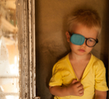 פזילה בילדים ובתינוקות – חשוב לדעת!-תמונה